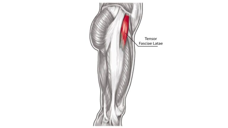Understanding and Treating Tensor Fasciae Latae Pain: A Complete Guide
